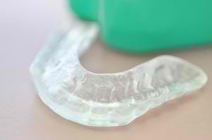 Teeth grinding can lead to serious dental problems - we offer night guards Shepherds Hill dental