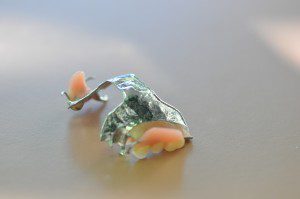 A cobalt chrome partial denture is one of the options for replacing missing teeth