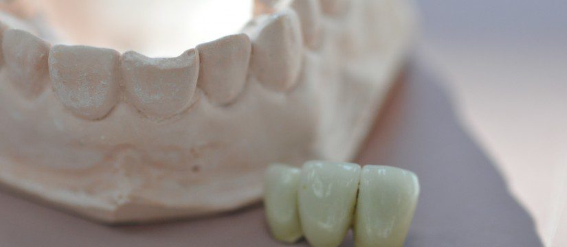 At Shepherds Hill Dental Centre we offer a variety of treatment options to help repair a cracked tooth