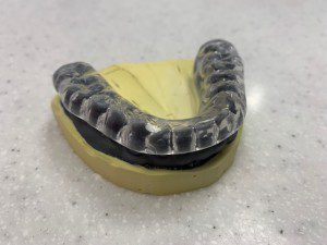 An Occlusal Splint ready for a patient